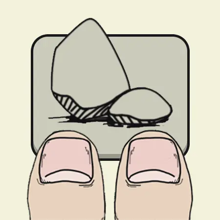 神手ICON